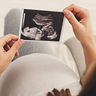 سونوگرافی داپلر در بارداری، همه اطلاعات لازم