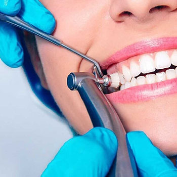 کامل‌ترین راهنمای جرم گیری دندان: روش، عوارض و مراقبت‌های بعدی