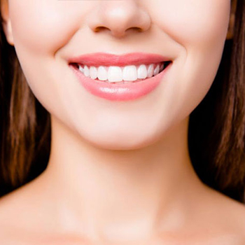 کامپوزیت بهتر است یا لمینت؛ مزایا و معایب هر کدام چیست؟