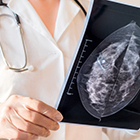 بهترین زمان ماموگرافی کی است؟