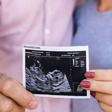 سونوگرافی تعیین جنسیت، در هفته چندم بارداری