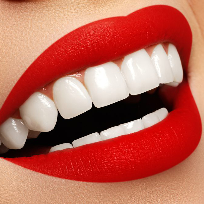 انواع خدمات زیبایی دندانپزشکی