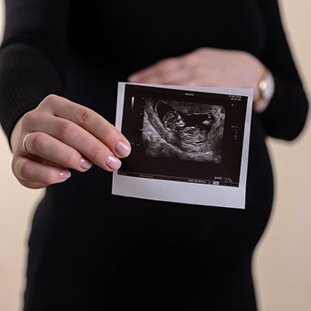 ۴ سونوگرافی ضروری در دوران بارداری