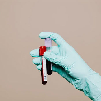  راهنمای کامل پره اکلامپسی یا مسمومیت بارداری - ۶ علائم شایع + عوارض و درمان