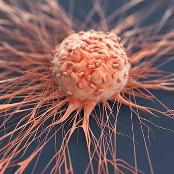 روشهای تشخیص فیبروم: سونوگرافی، MRI، هیستروسکوپی