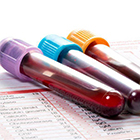 تست تحمل گلوکز (GTT) یا آزمایش قند خون در بارداری چیست؟
