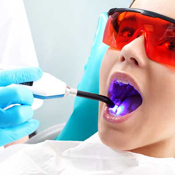 کاربرد لیزر در دندانپزشکی نوین