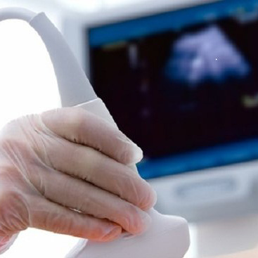 سونوگرافی داپلر در بارداری، دلیل و نحوه انجام آن