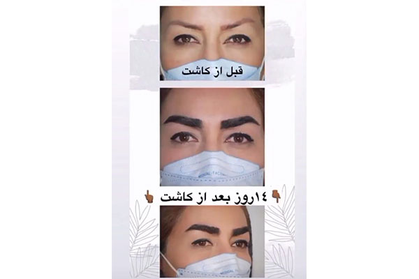 متخصص جراحی لاغری و زیبایی، دکتر شاپور عزیزی